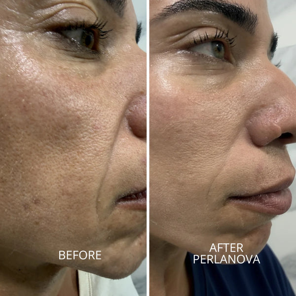 Freeze-dried collagen booster serum — NanoActive silk ball system
