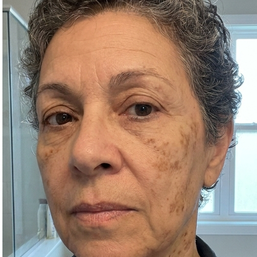 Carol J. - 3 TUBES CLEAR-OUT PROTOCOL