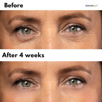 Micro-infusion EyePatches