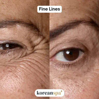 Fine lines