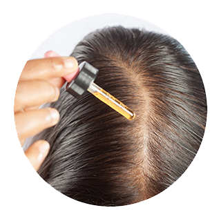 Minoxidil (Foam / Liquid)