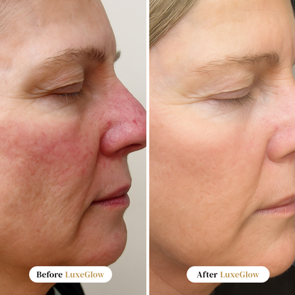 LuxeGlow™ Micro-Infusion System + Ebook Included