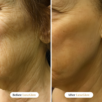 LuxeGlow™ Micro-Infusion System + Ebook Included